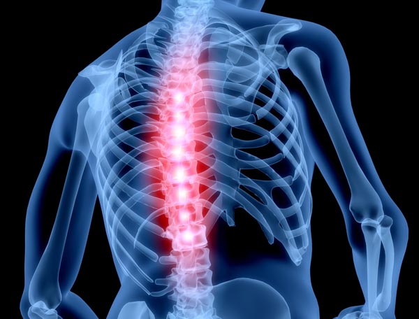 usuwanie bólów kręgosłupa Częstochowa